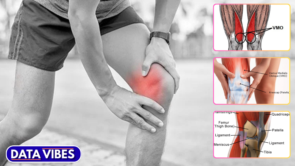 Vastus Medialis Knee Pain